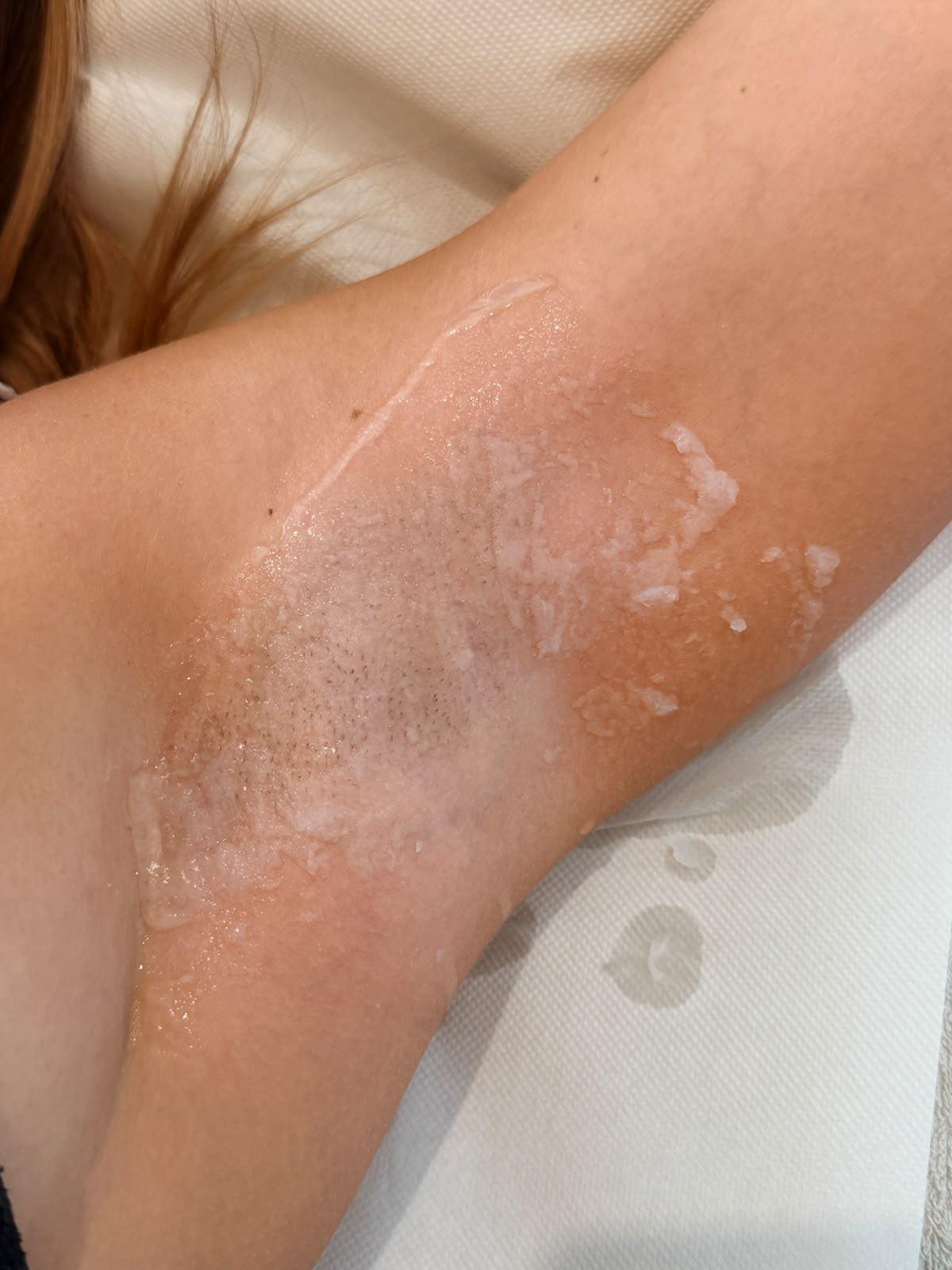 Lo scrub total body